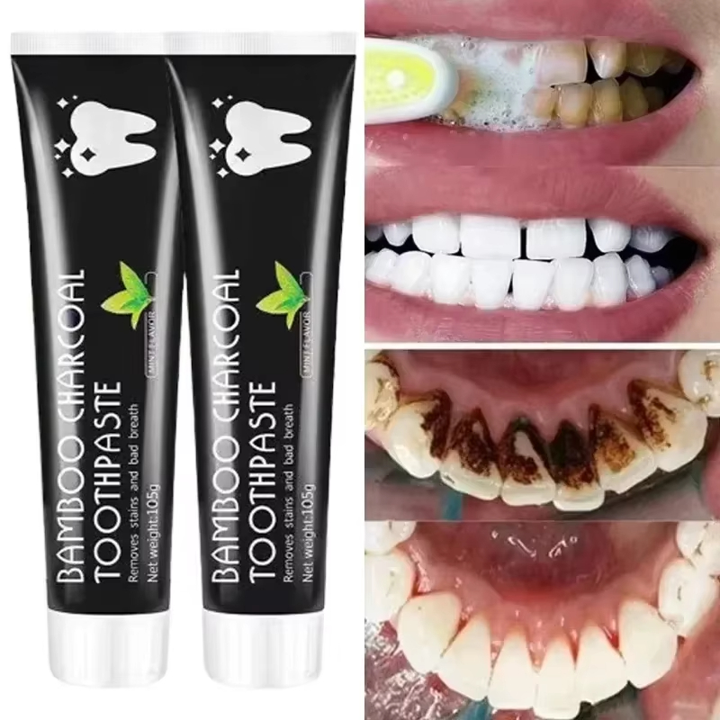 Teeth Whitening Yellow Teeth - Beyazlatıcı Diş Macunu Bambu Kömürü Diş