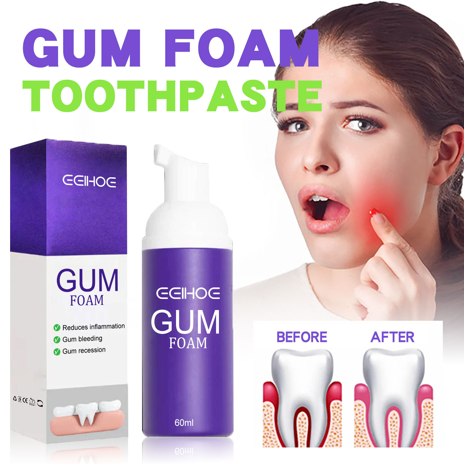 Teeth Whitening Yellow Teeth - 60 ml Diş Beyazlatma Köpüğü V34