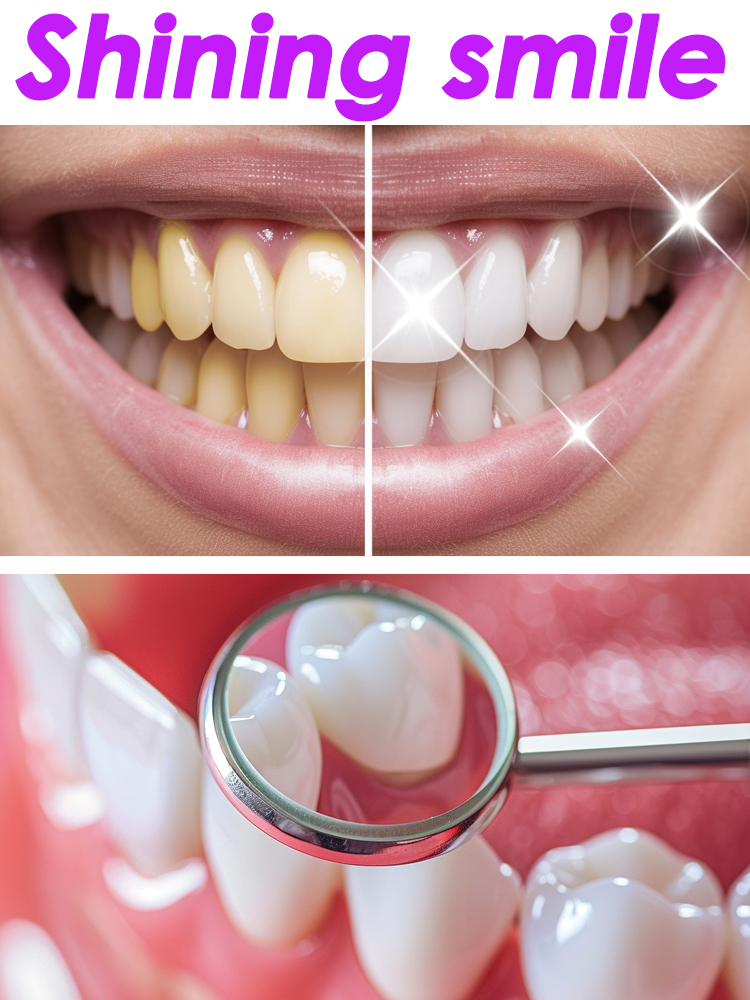 GlorySmile Diş Beyazlatma Meyv - Teeth Whitening Xylitol incelemesi ve fiyatı