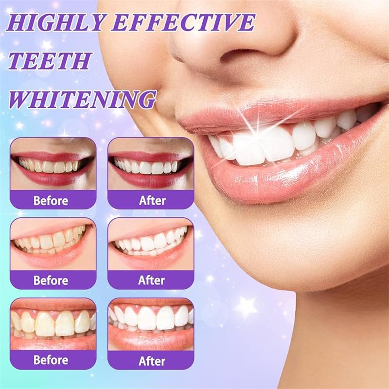 9D Mor Diş Beyazlatıcı Diş Mac - Teeth Whitening Yellow Teeth incelemesi ve fiyatı