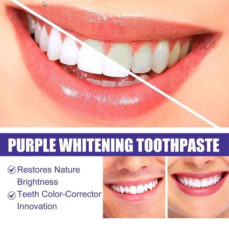 9D Mor Diş Beyazlatıcı Diş Mac - Teeth Whitening Yellow Teeth incelemesi ve fiyatı