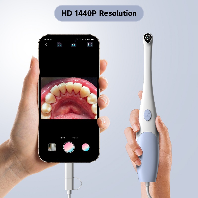 Oral Endoskop Kamera 1440P Fot - Teeth Whitening Video incelemesi ve fiyatı