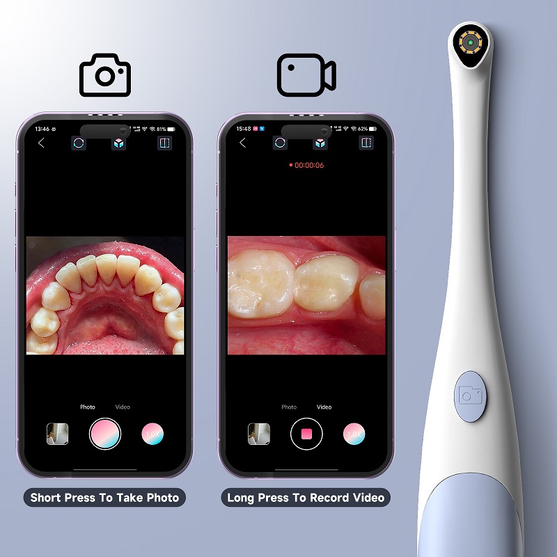 Oral Endoskop Kamera 1440P Fot - Teeth Whitening Video incelemesi ve fiyatı