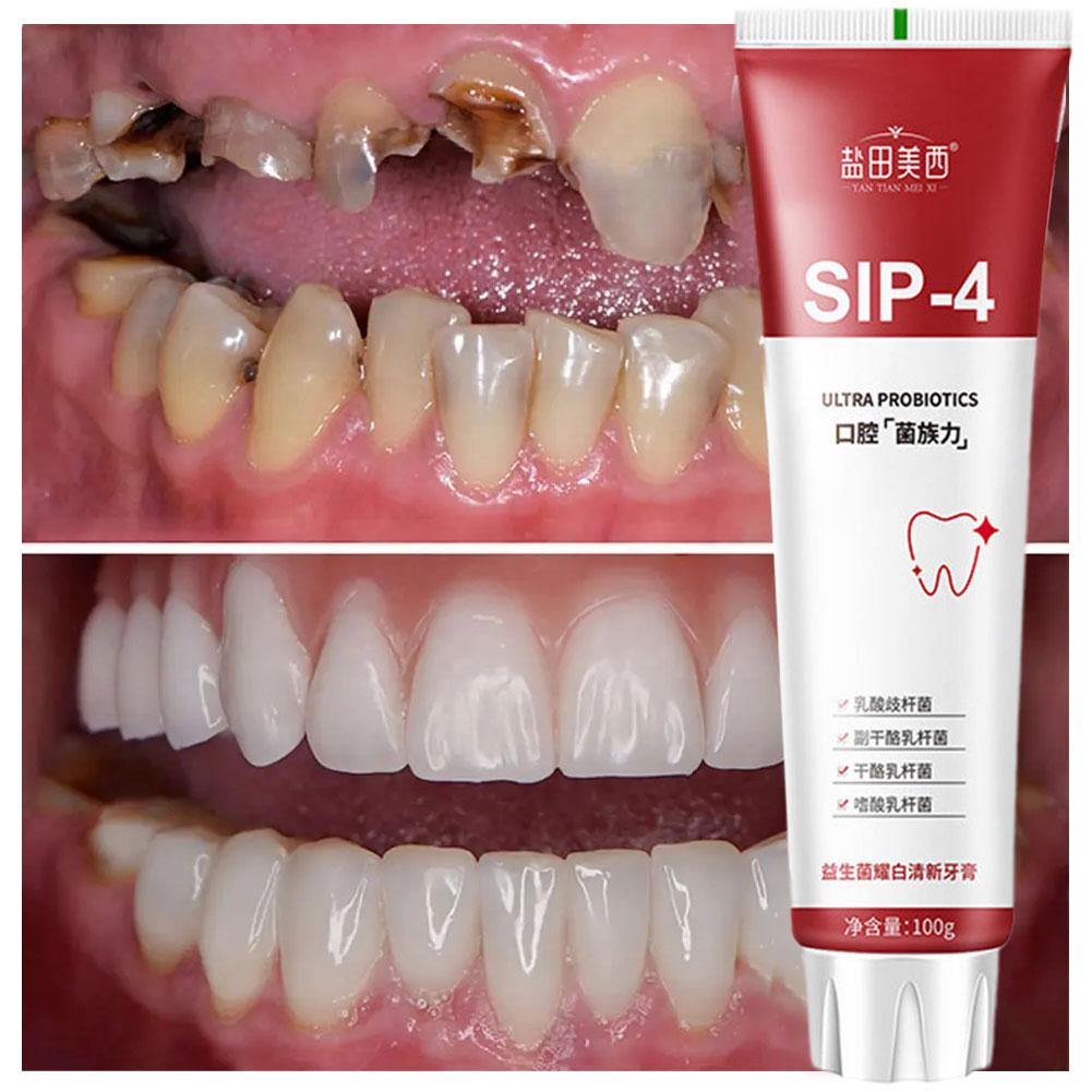 100g Sip-4 Probiyotik Beyazlat - Teeth Whitening Yellow Teeth incelemesi ve fiyatı