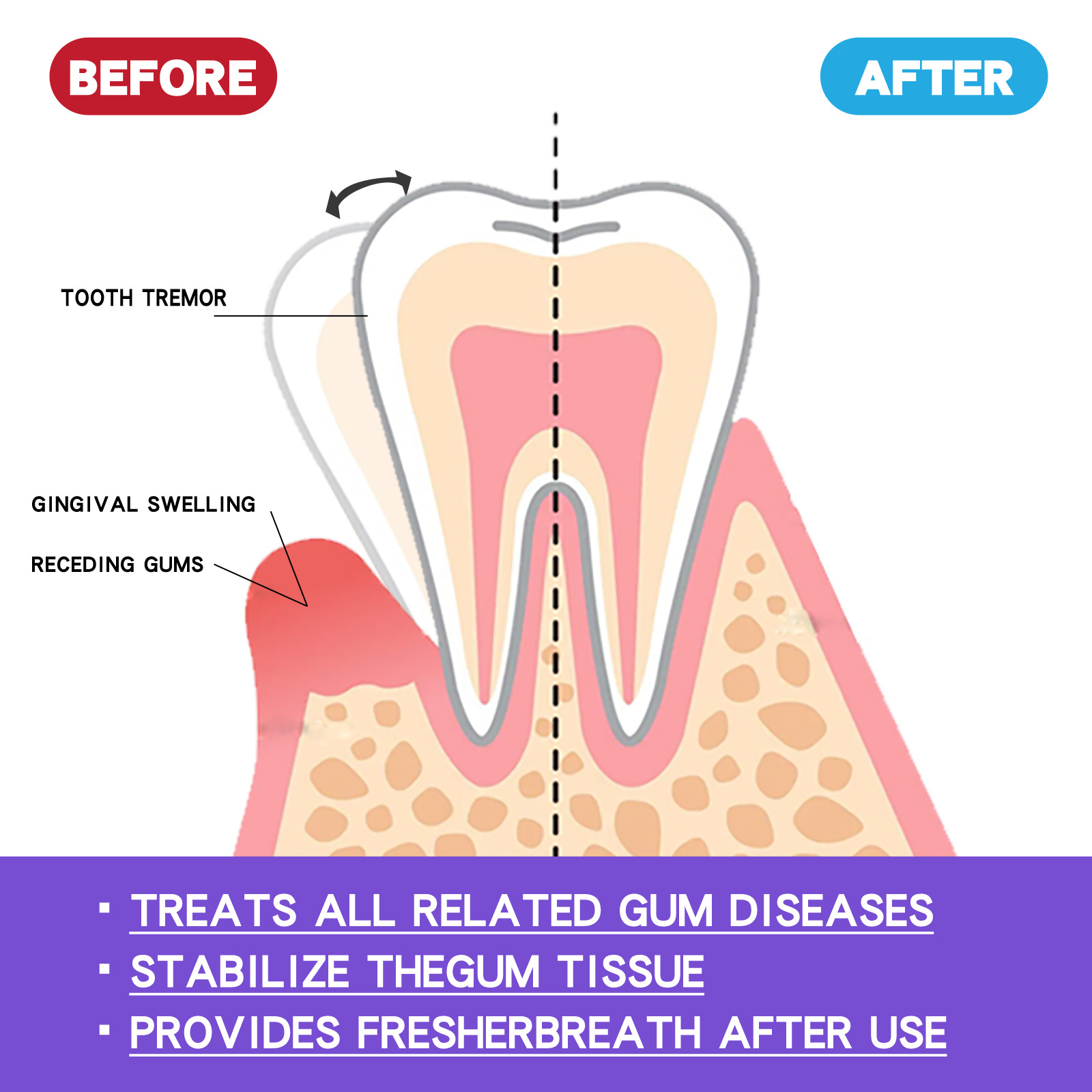 60 ml Diş Beyazlatma Köpüğü V3 - Teeth Whitening Yellow Teeth incelemesi ve fiyatı