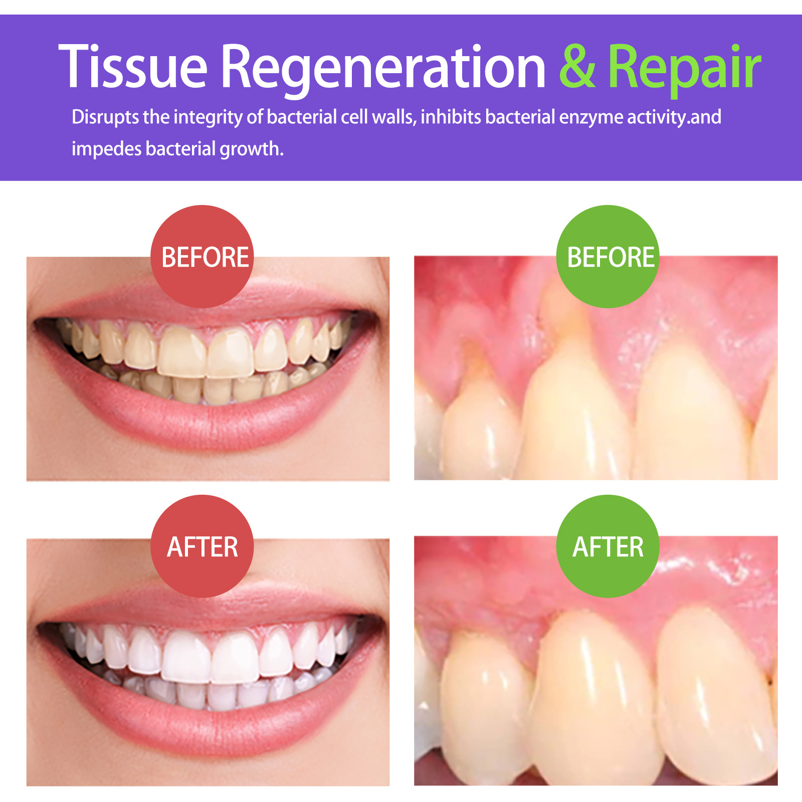 60 ml Diş Beyazlatma Köpüğü V3 - Teeth Whitening Yellow Teeth incelemesi ve fiyatı